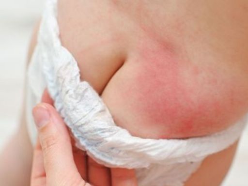 Cuidados a ter e o que evitar no skincare infantil 