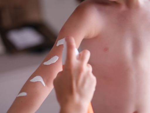 Quais são os problemas de pele mais comuns nas crianças? 