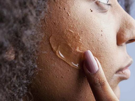 Prevenção de manchas de espinha: gel antiacne Papuless®