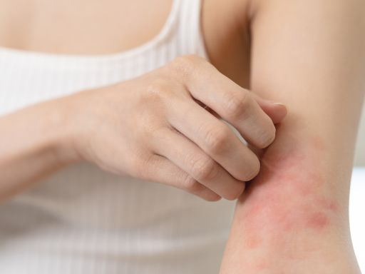 Condições comuns em peles sensíveis 