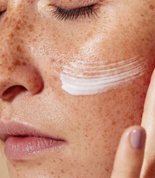 Como escolher creme para manchas na pele? Top clareadores!