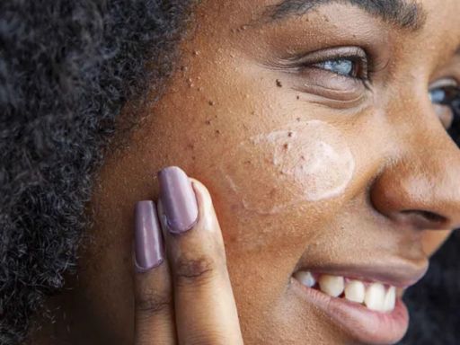 Melhores cremes para manchas na pele do rosto: clareadores Klassis®