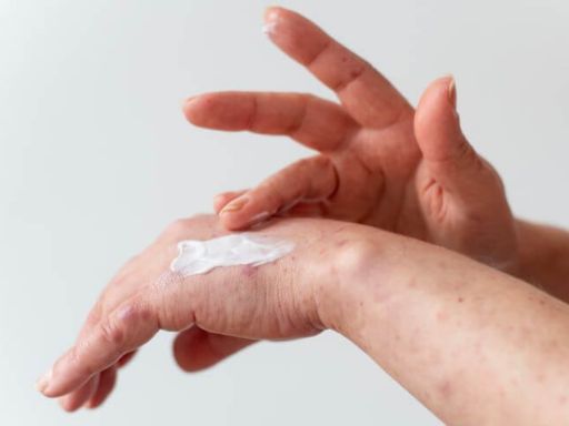 Profissionais da equipe multidisciplinar oncológica: dermatologista